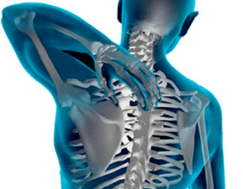 The manifestations of thoracic vertebrae